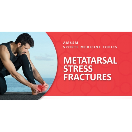 METATARSAL STRESS FRACTURES | Sports Medicine Today